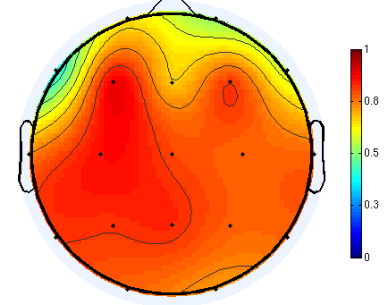 EEG head map 1 45.png